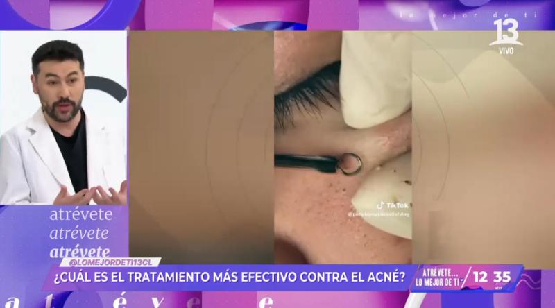 Atrévete... Lo mejor de ti - Créditos: Captura