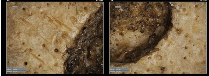 Lesiones tumorales que se observaron en uno de los cráneos.