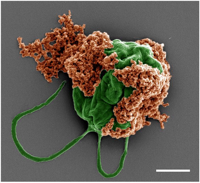 Imagen en color de un microrobot hecho de una célula de alga (verde) cubierta con nanopartículas llenas de fármaco (naranja) recubiertas con membranas de glóbulos rojos | Créditos: Revista ‘Science Advances’