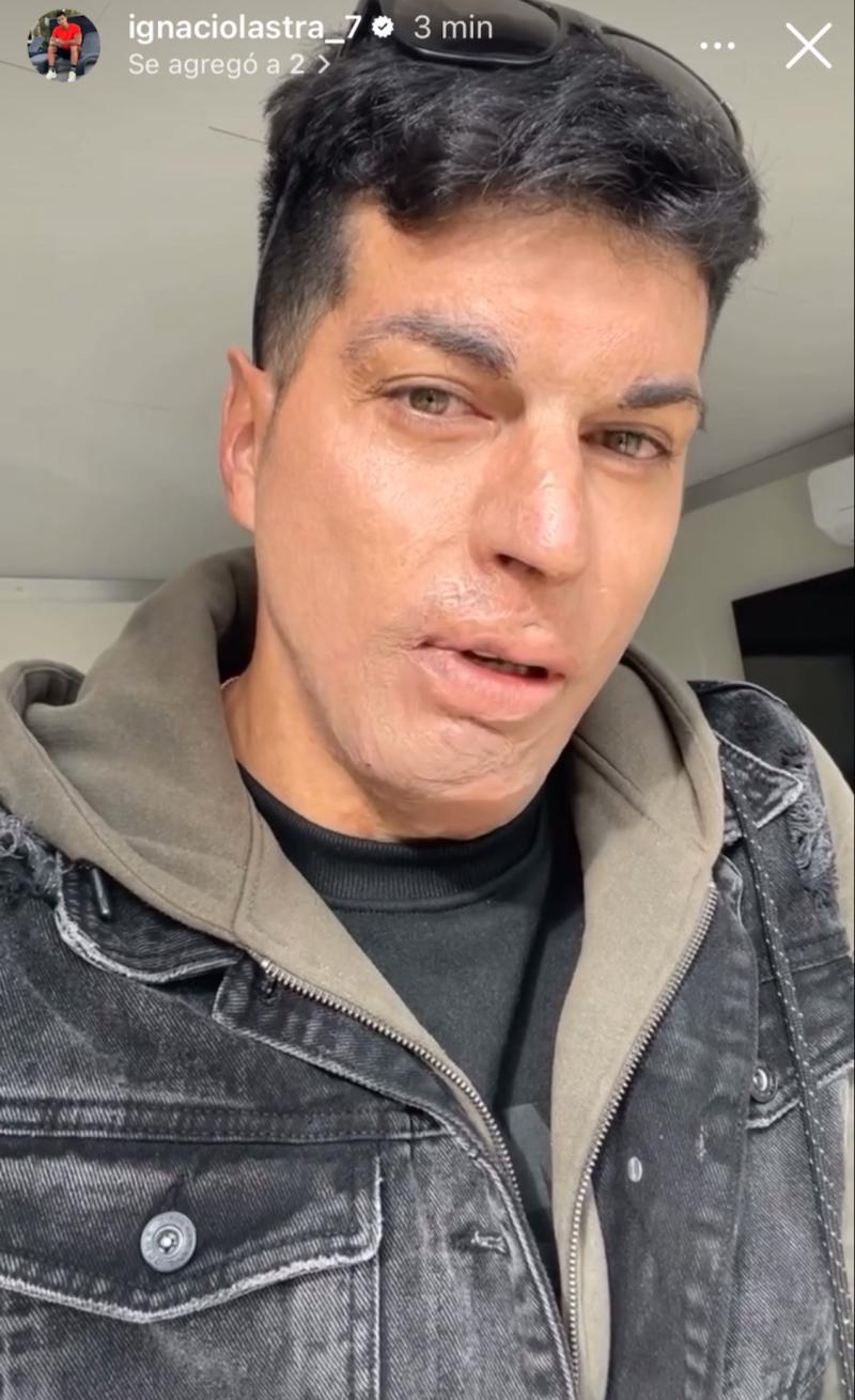 Ignacio Lastra - Instagram
