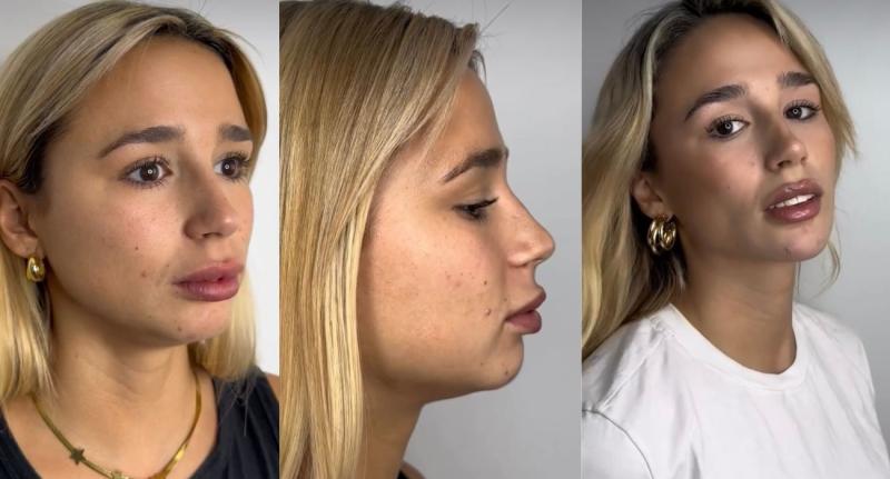 Mira el antes y después de Guarén - Instagram