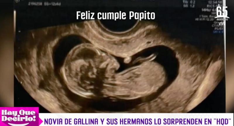 Rodrigo Gallina y Karina León serán padres - Hay que decirlo