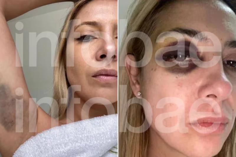 Las fotos de Fabiola Yáñez, expareja de Alberto Fernández - Créditos: Infobae