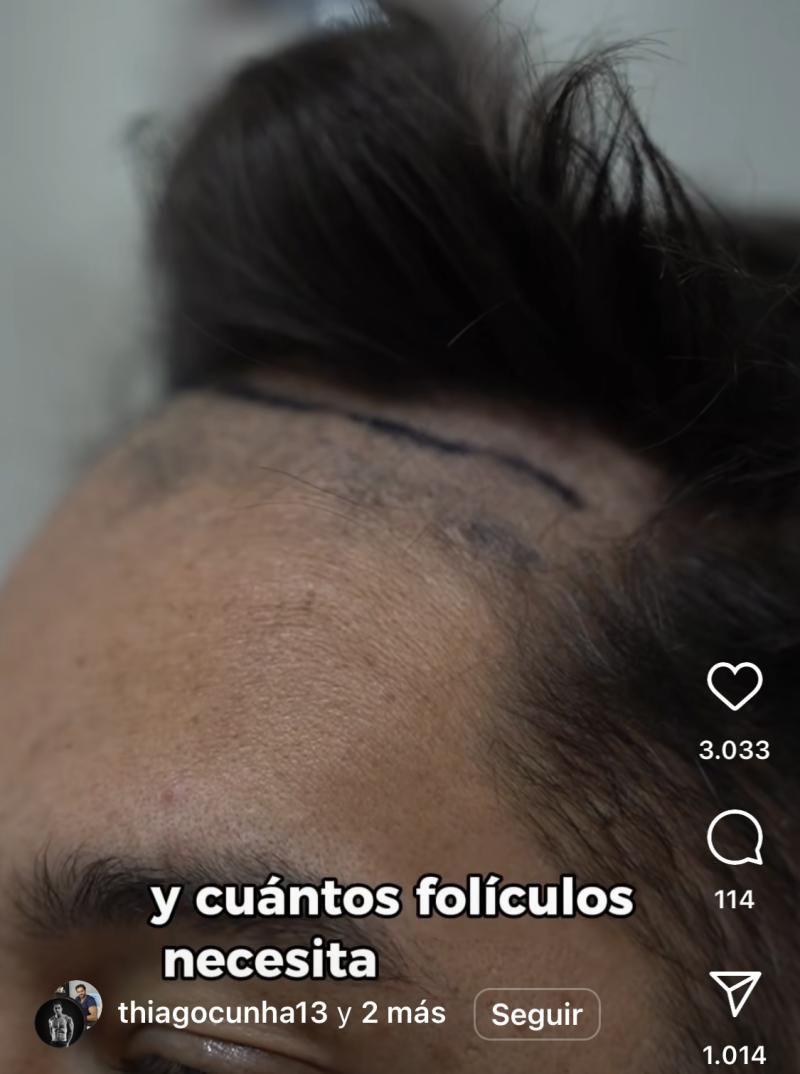 Thiago Cunha - Instagram