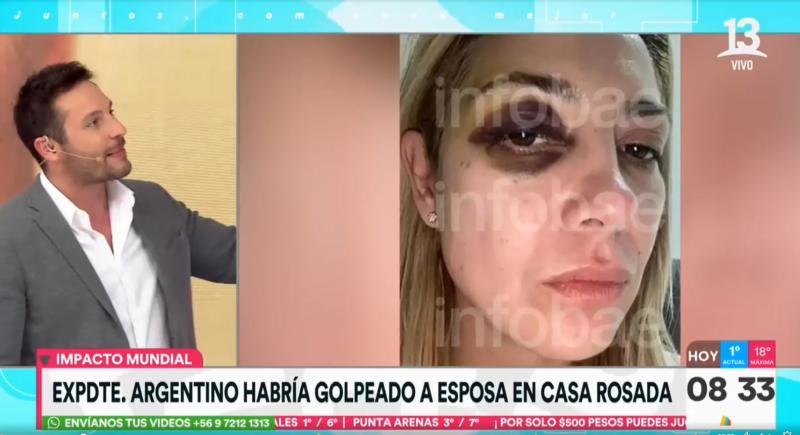 Estas son las fotos y los chats presentados como pruebas contra Alberto Fernández en denuncia por violencia de género