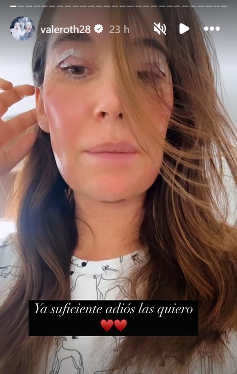 Vale Roth se realizó invasivo procedimiento estético en su rostro.