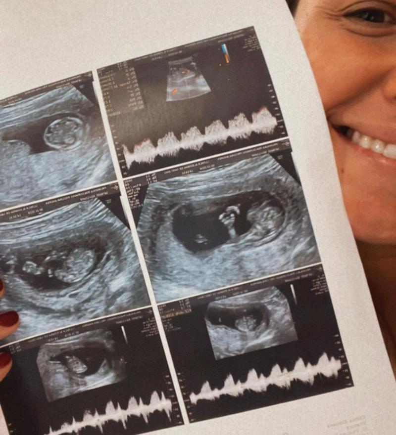 Paulina Prohaska, ex actriz de "BKN" - Instagram