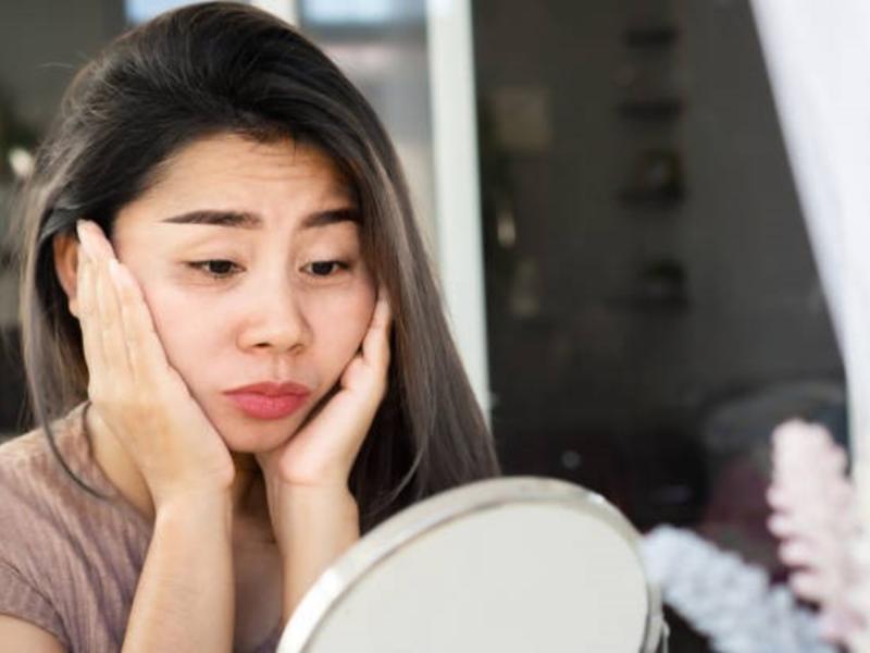 "Cara de cortisol": cómo los altos niveles de estrés pueden llegar a afectar tu rostro