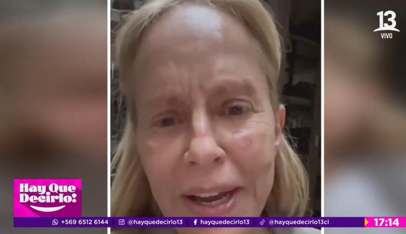 Esta es la razón por la que Cecilia Bolocco no estará en la Teletón 2024