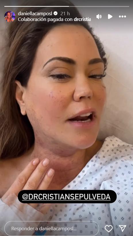 Daniella Campos mostró el nuevo procedimiento estético que se realizó.