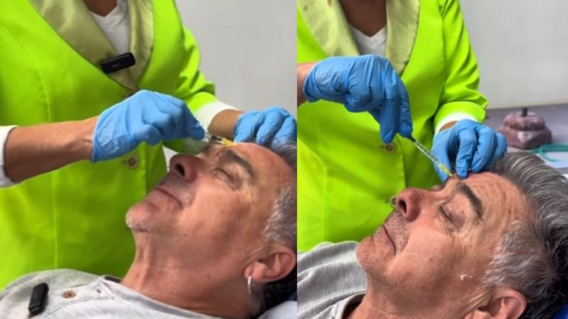 Pato Torres se sometió a rejuvenecedor procedimiento estético.