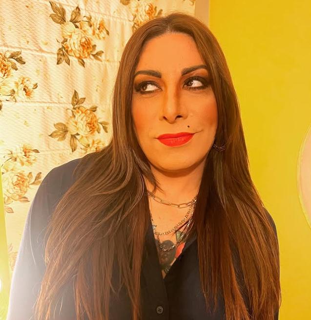 Botota Fox presumió importante procedimiento estético al que se sometió.