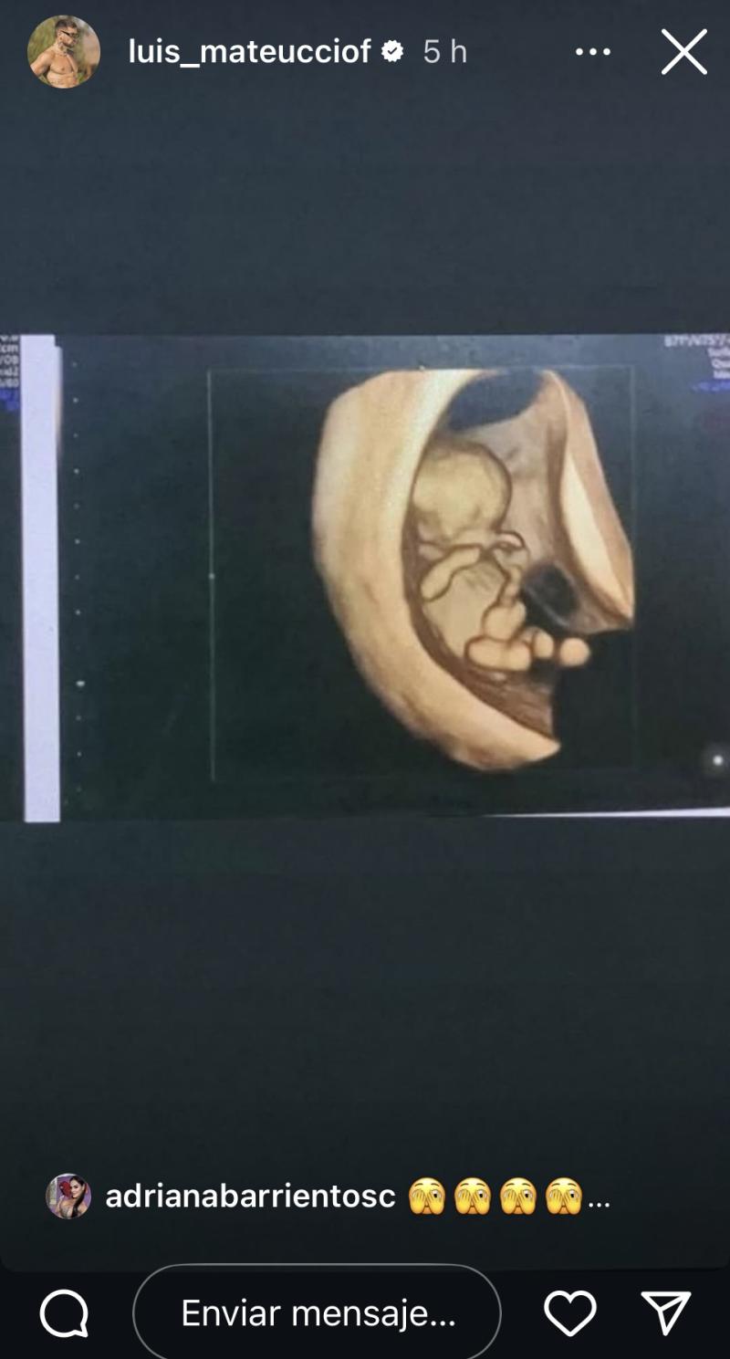 Luis Mateucci - Instagram