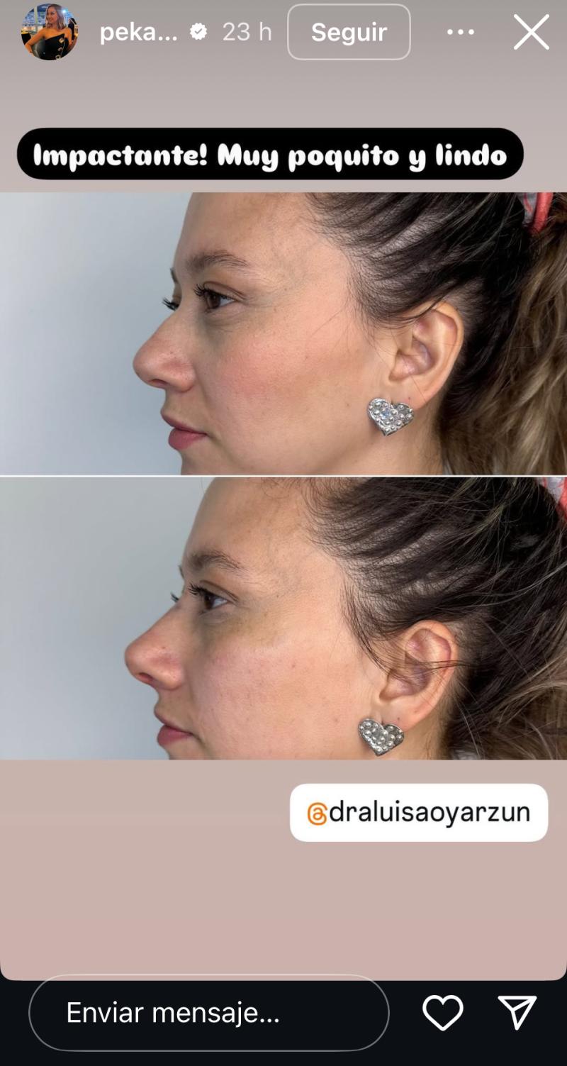 Ingrid Parra - Instagram