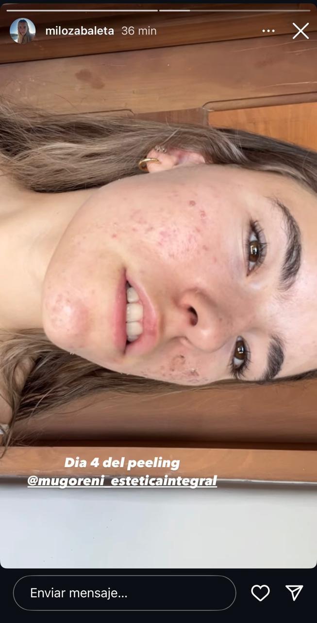 Milagros Zabaleta muestra su rostro tras su tratamiento.