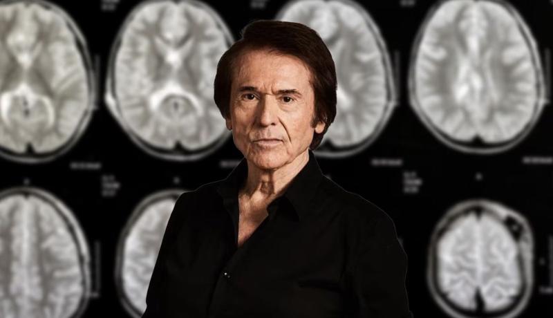 ¿Qué es un linfoma cerebral?: Doctor Ugarte explica esta enfermedad y sus síntomas