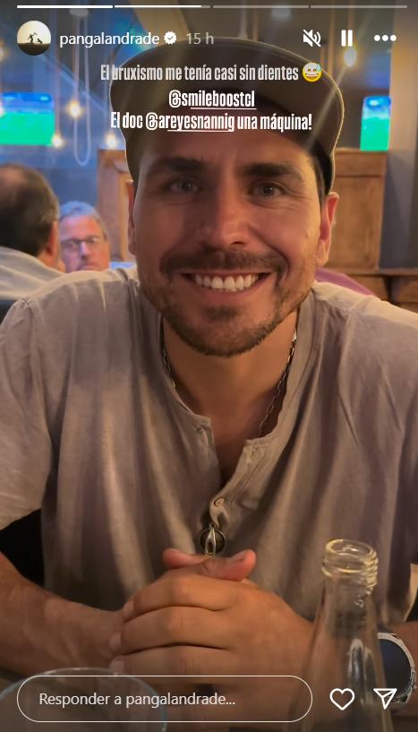 Así luce Pangal Andrade tras someterse a un diseño de sonrisa.