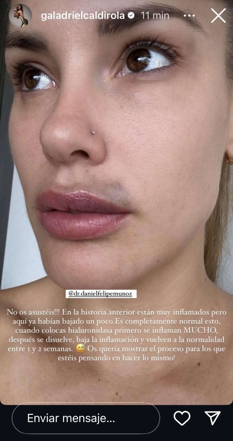 Gala Caldirola - Instagram