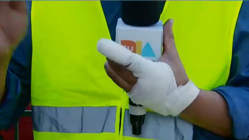 El dedo de Cristian Acuña, periodista de "Tu Día"