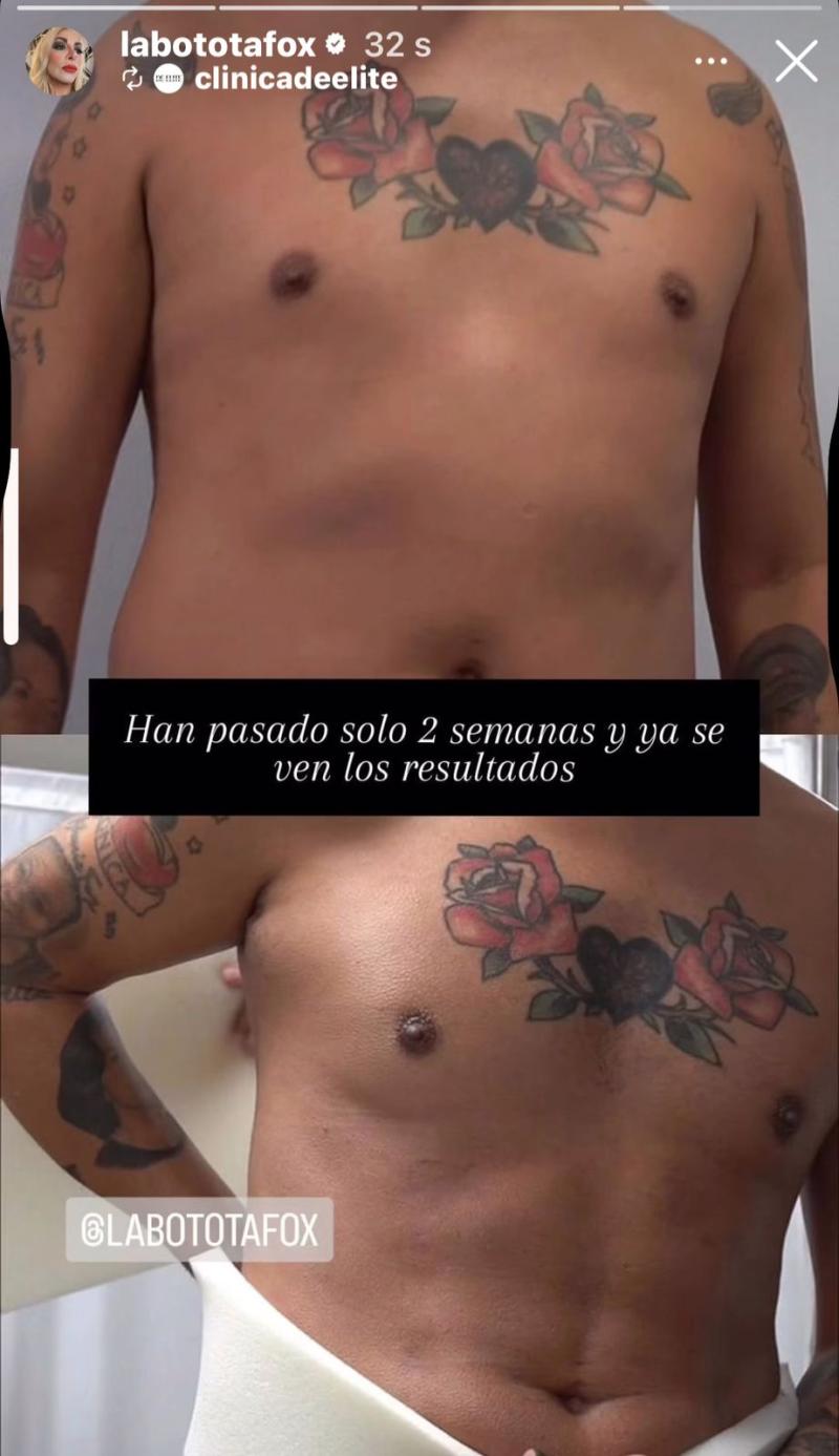 Resultados de la operación de Botota Fox - Captura de Instagram