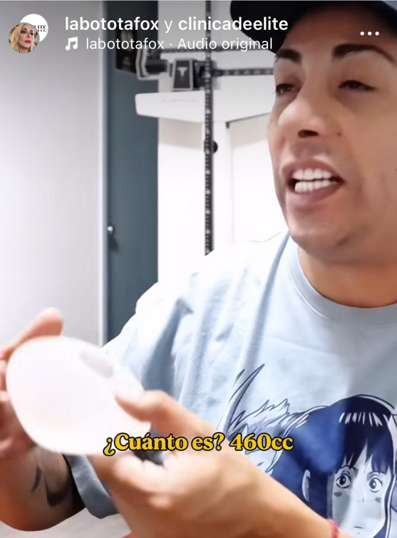 Botota Fox - Instagram