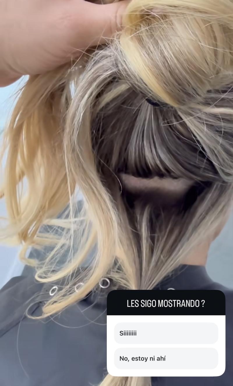 Coté López se somete a injerto capilar - Instagram