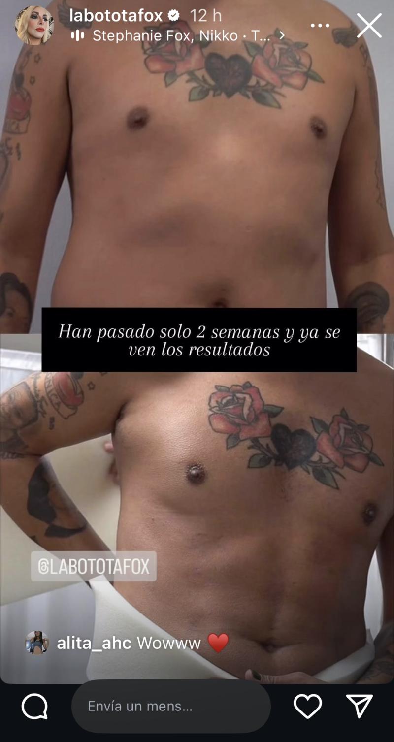 Botota Fox - Instagram