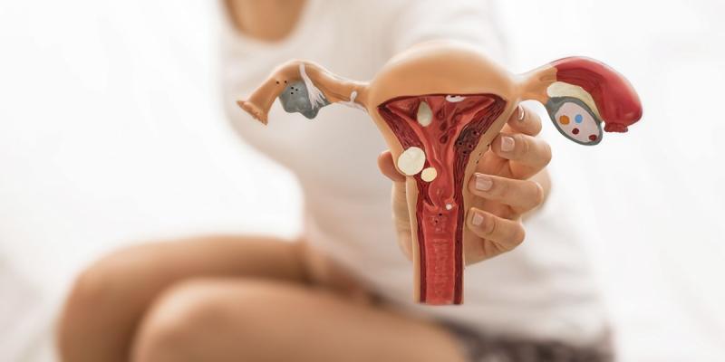 Día de la Endometriosis: síntomas, diagnóstico y tratamientos. Pexels.