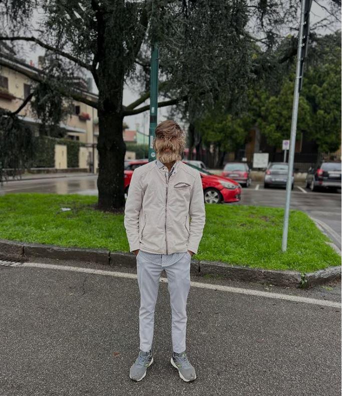 Joven con la cara más velluda del mundo.