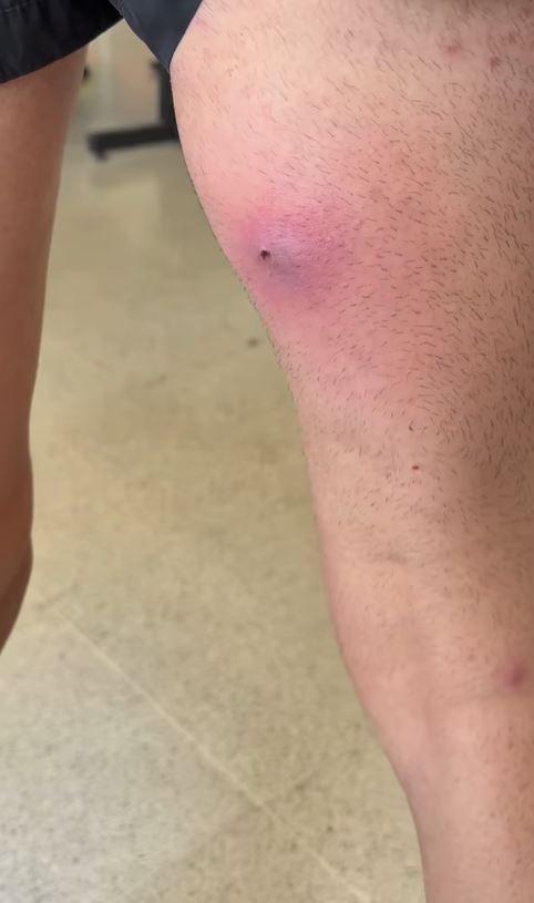 Pierna de Reina de Chile - Instagram