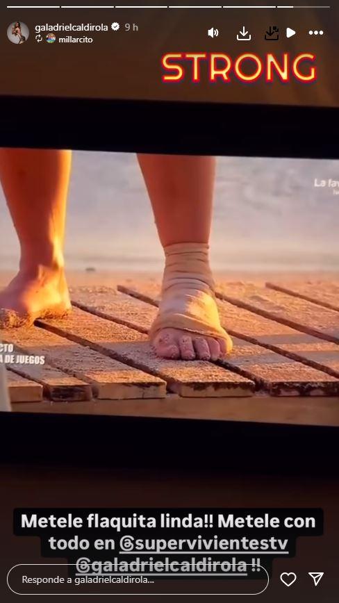 Así quedó el pie de Gala tras el accidente - Instagram