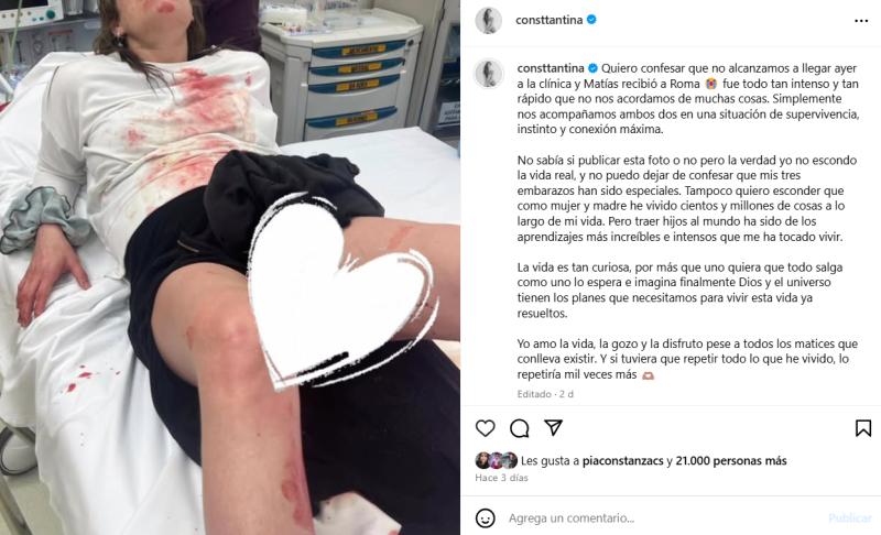 Tanza Varela | Instagram