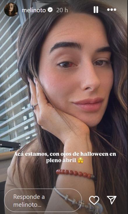 Melina Noto | Instagram