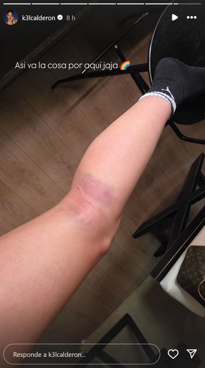 Kel Calderón - Instagram.