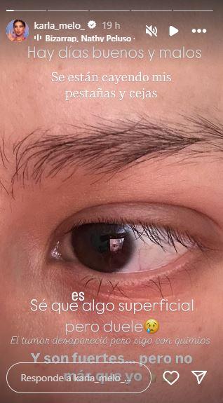 Karla Melo - Instagram