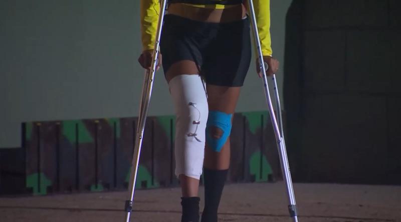 Así quedó Fanny tras la caída