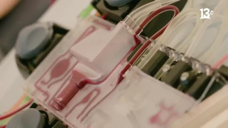 Bolsas de sangre. Créditos: Factor de Cambio.