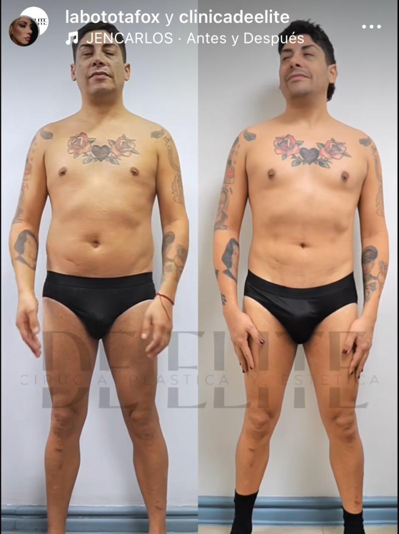 Botota Fox - Instagram