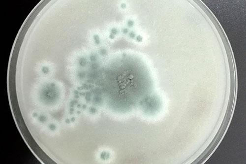 Estudios revelan que hongos peligrosos podrían expandirse por el mundo. Créditos: U. de Chile.