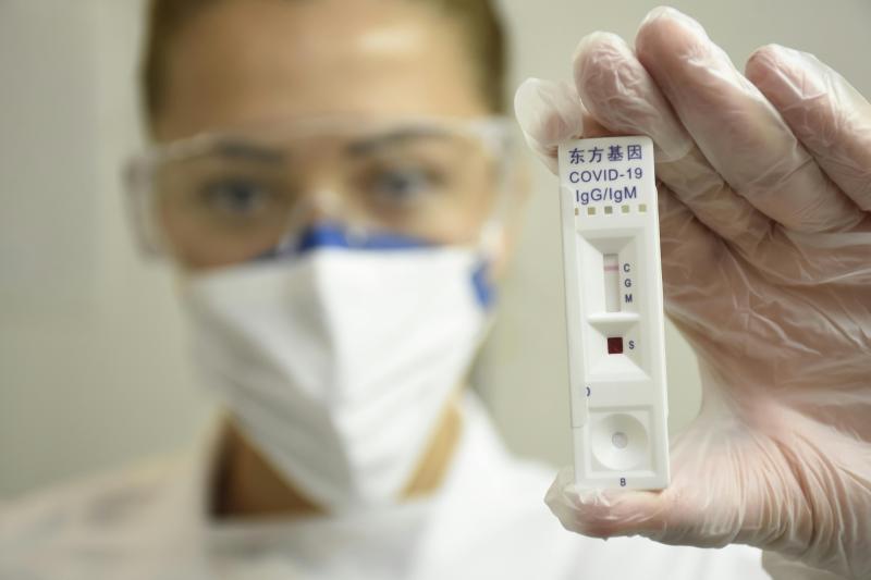 Test de covid-19. Créditos: Pexels.