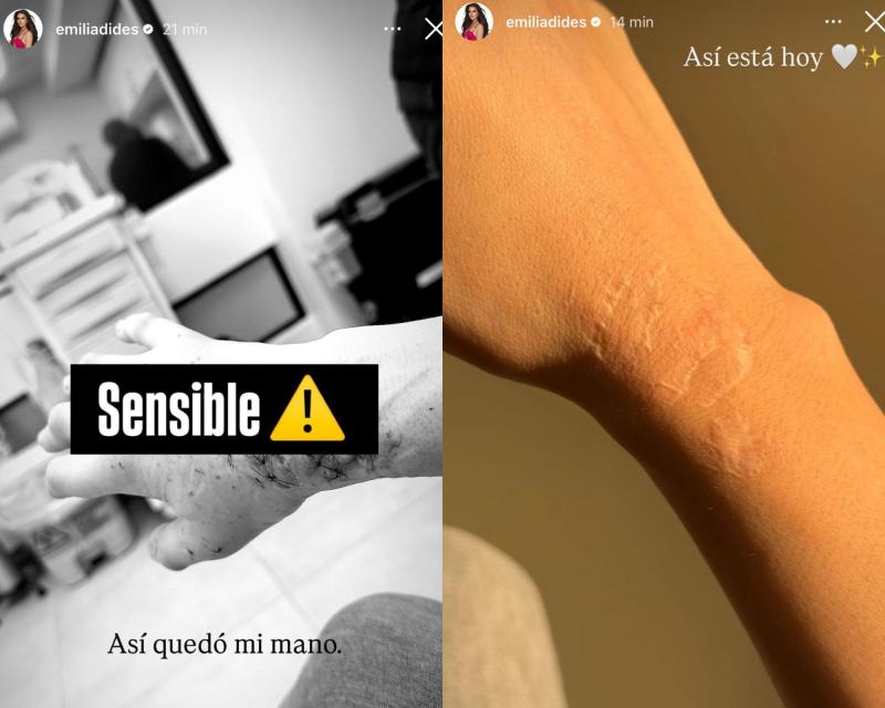 Historia de Emilia Dides | Instagram