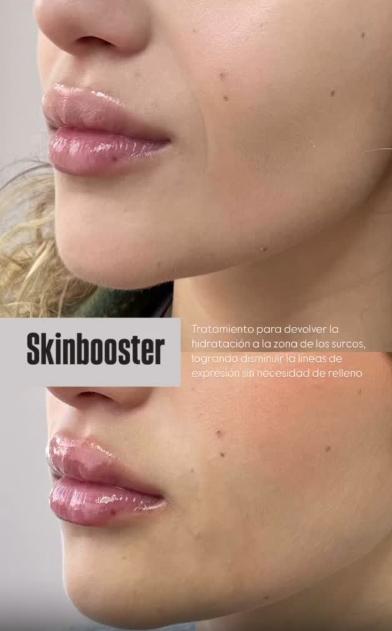 Piel de Trini Neira antes y después - Instagram