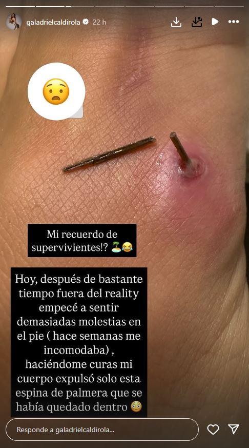 Foto del pie de Gala Caldirola - Instagram