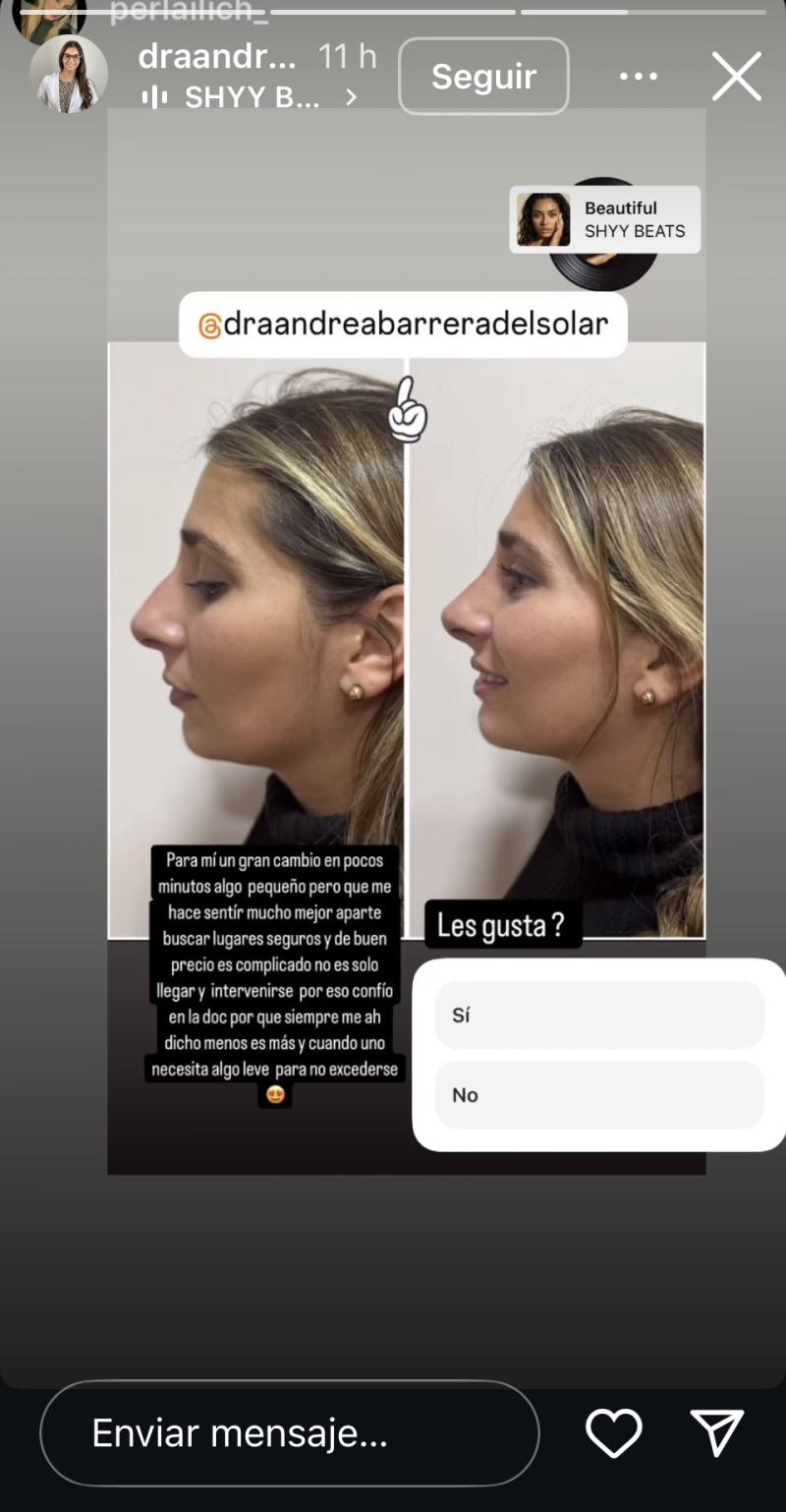 Perla Ilich - Instagram