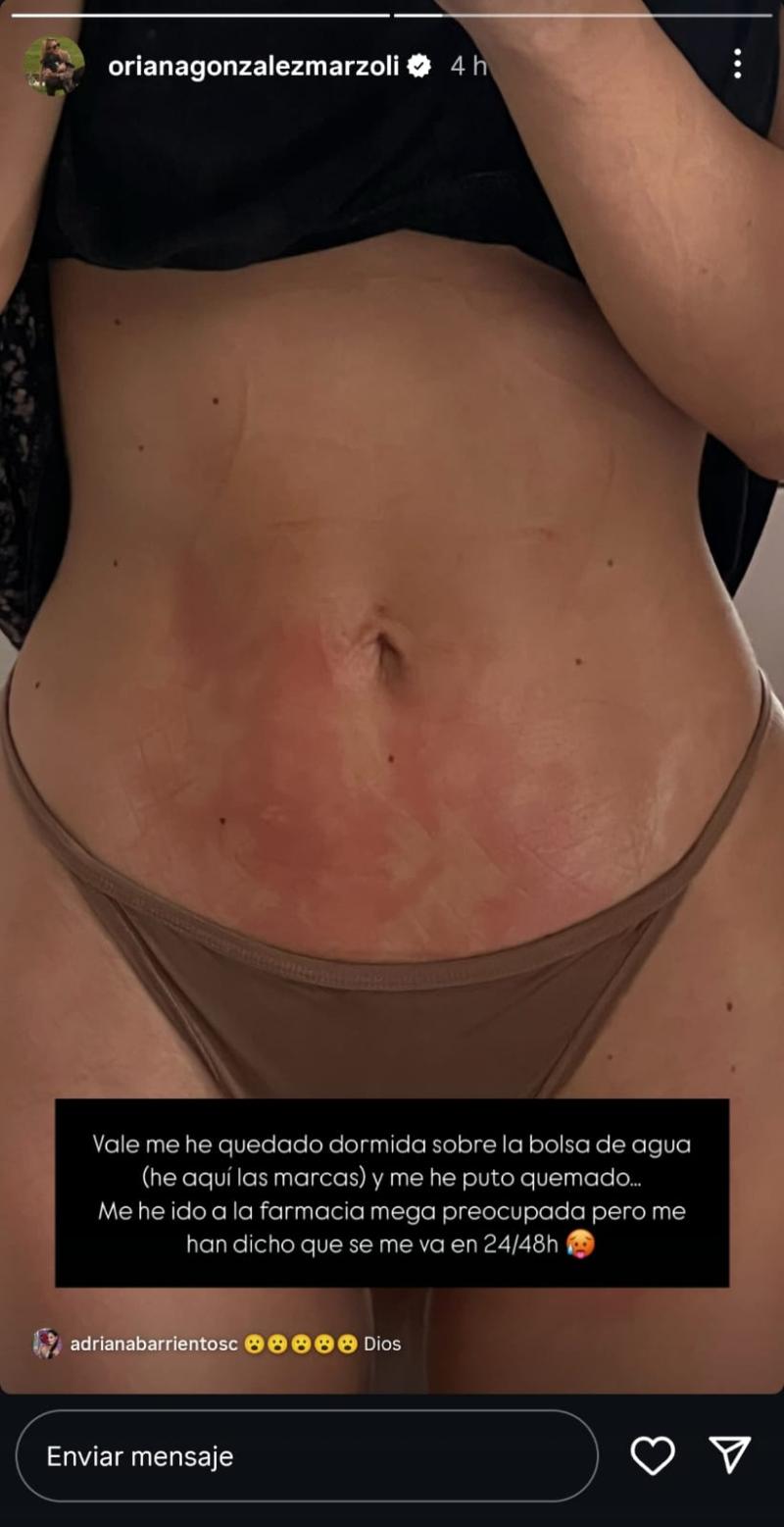 Oriana Marzoli - Instagram