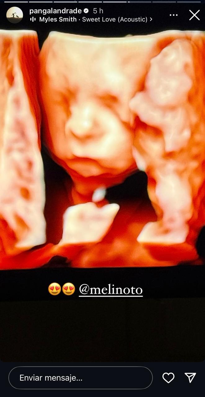 Pangal Andrade - Instagram.