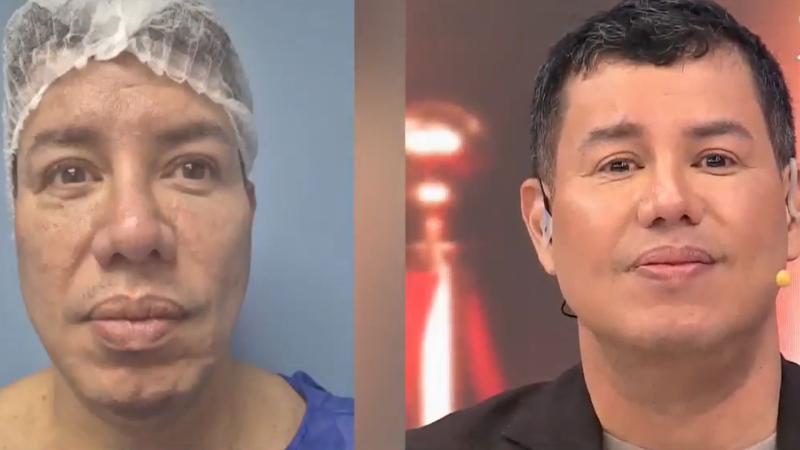 El antes y el después de El Colombiano, integrante de "Tu Día"