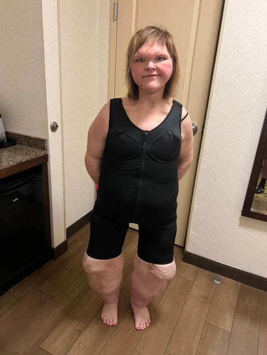 Protagonista de Kilos Mortales sorprendió con su impactante cambio físico - Redes sociales