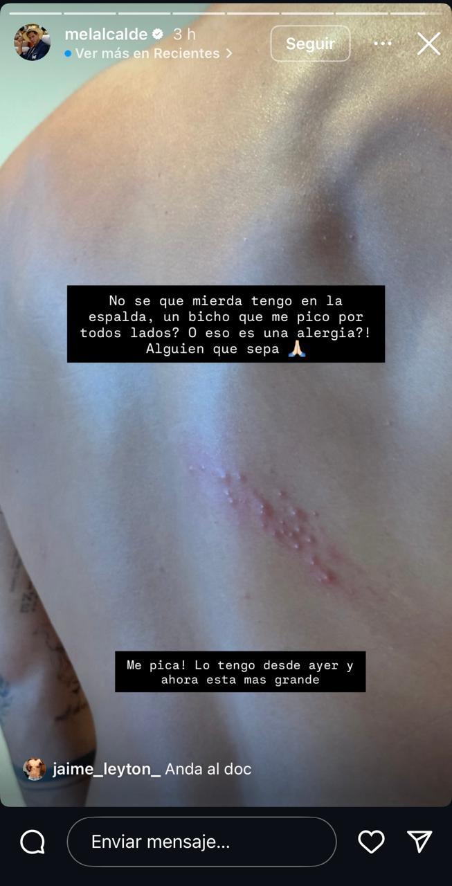 Mel Alcalde - Instagram.