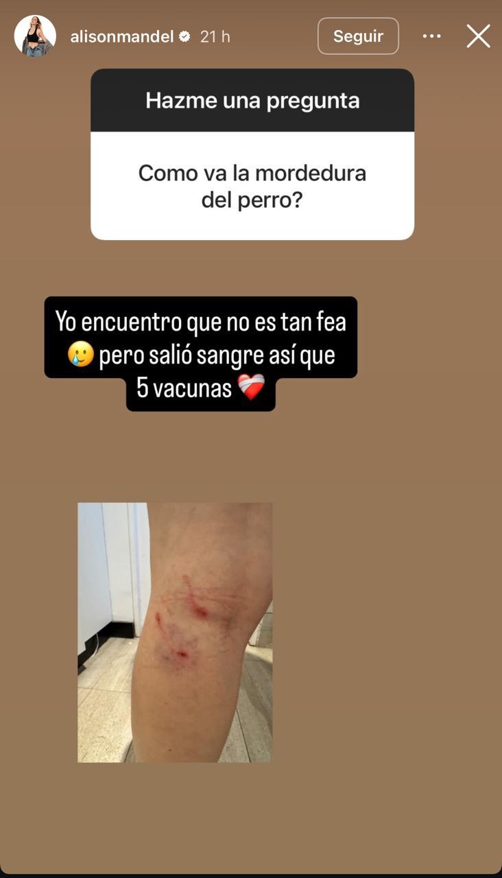 Historia de Alison Mandel | Instagram